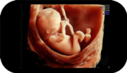 4D Baby Scans in Aberdeen - Watch Your Baby’s Development As it happen